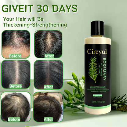Rosemary Biotin Shampoo - Volumizing, Sulfate-Free, for Thinning, Dry, Damaged Hair, Vegan, Color-Safe, , Suitable for both men and women